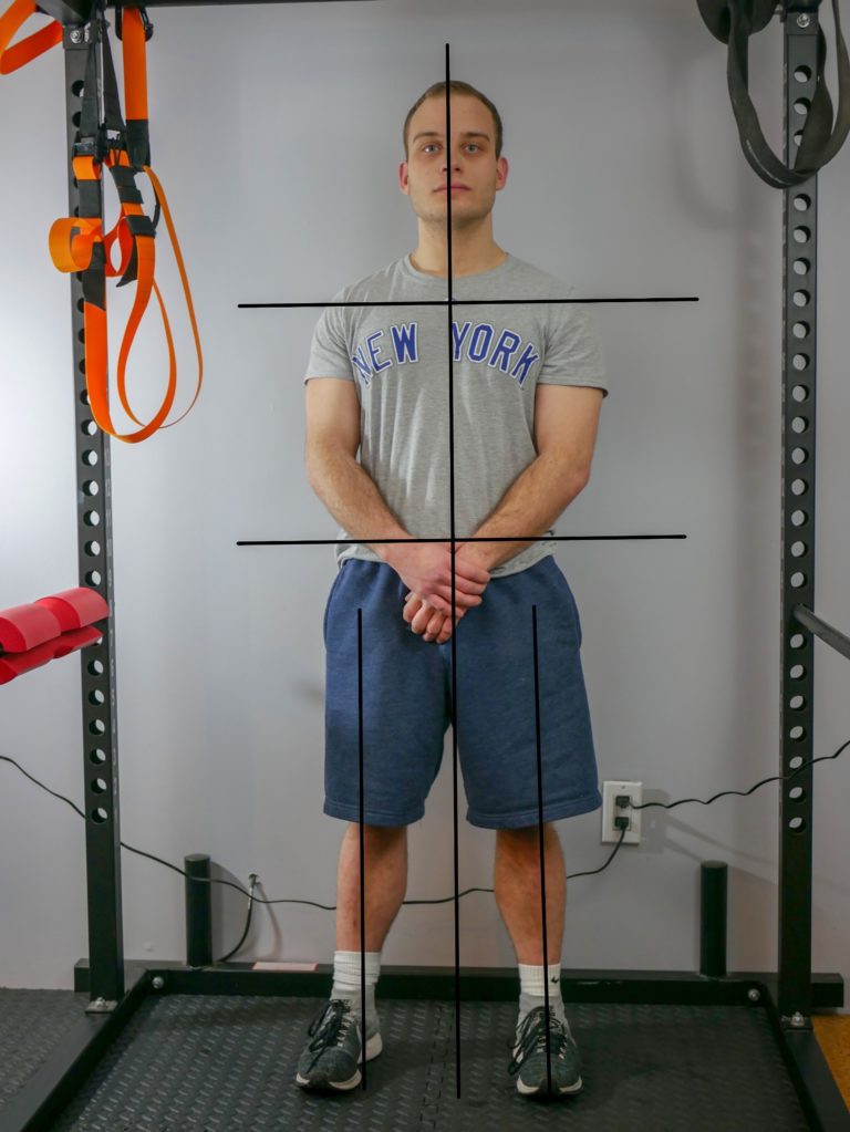 Static Posture Assessment Strong Links Fitness