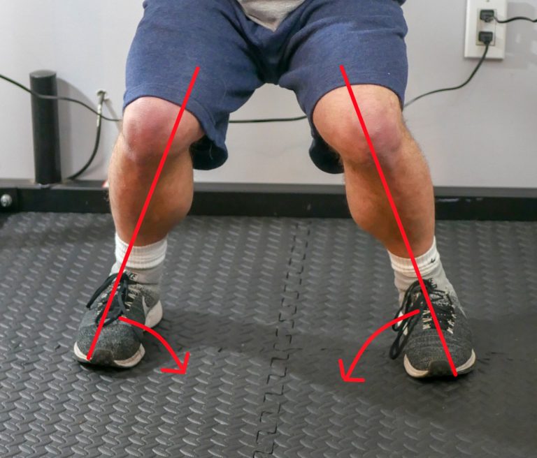 Feet, ankle, and knee muscle imbalances - Strong Links Fitness