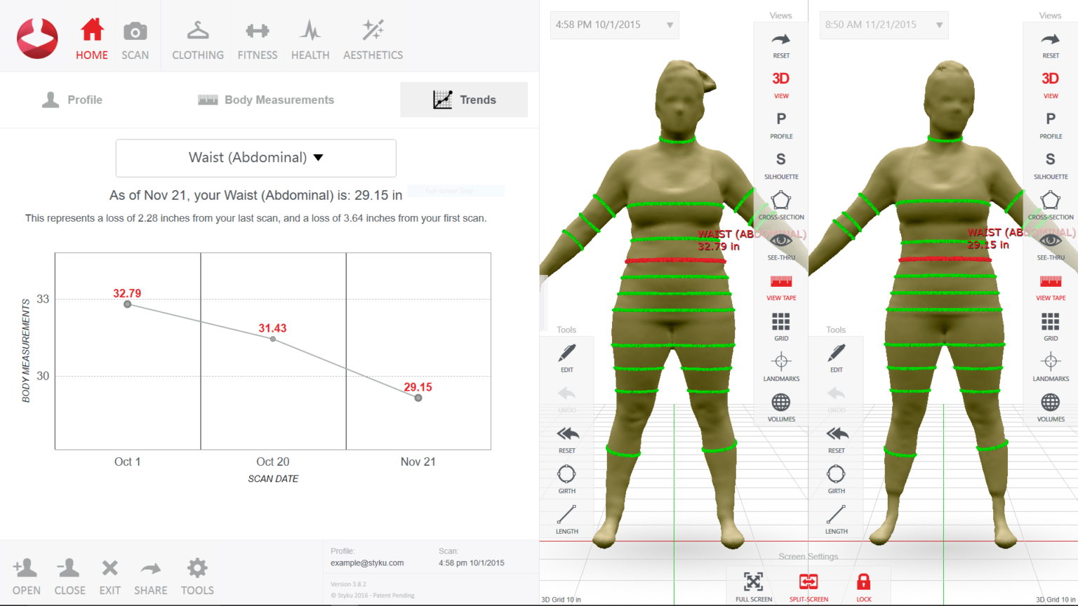 What is a Styku scan and how can it help you track your progress